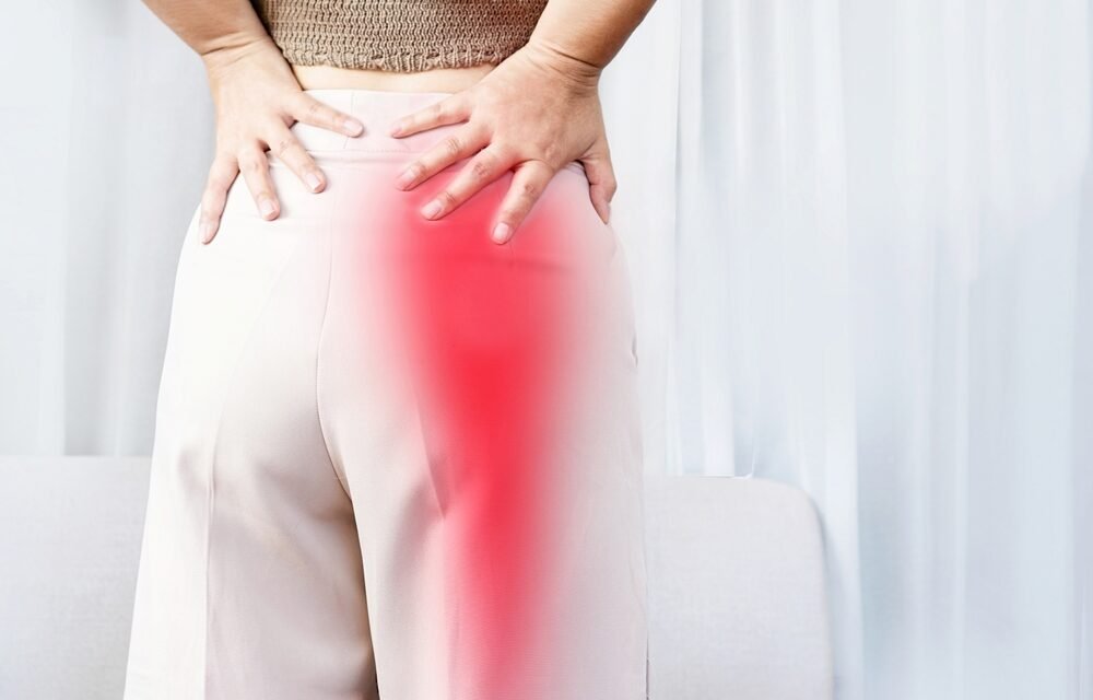 Cupping therapy for sciatica