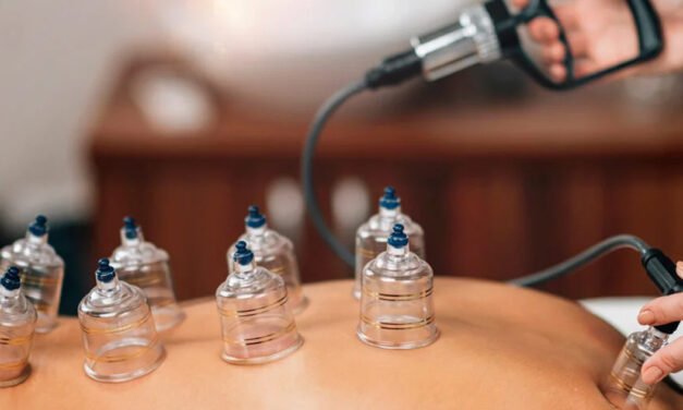 Techniques and Methods