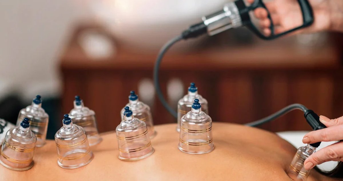 Techniques and Methods