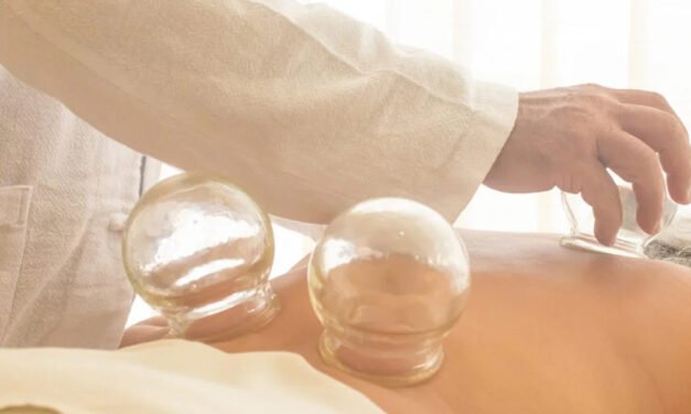 Dry Cupping Explained: The Raw Truth About Benefits, Marks, and Recovery