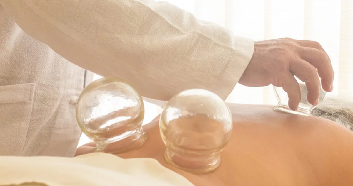Dry Cupping Explained: The Raw Truth About Benefits, Marks, and Recovery