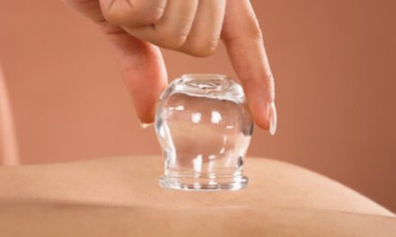 The Benefits of Cupping Therapy: A Holistic Approach to Wellness