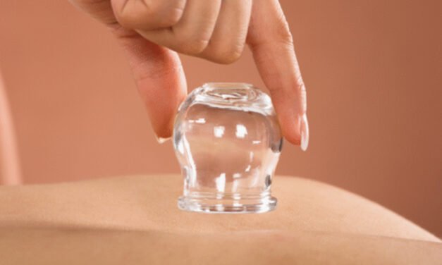 The Benefits of Cupping Therapy: A Holistic Approach to Wellness