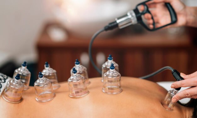 Dry Cupping