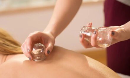 Cupping Therapy for Skin Health: A Natural Glow