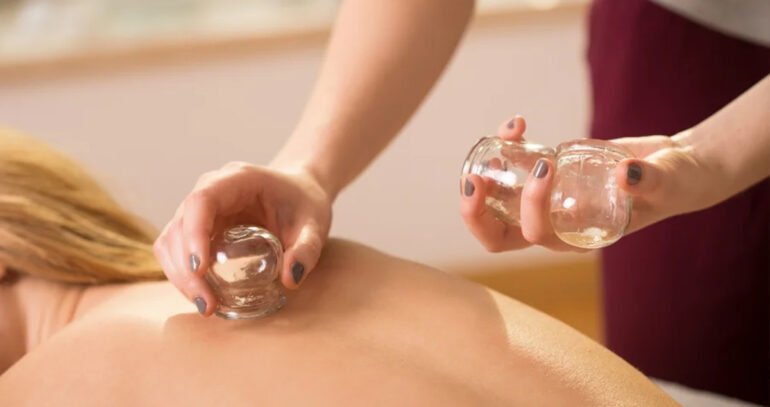 Cupping Therapy for Skin Health: A Natural Glow
