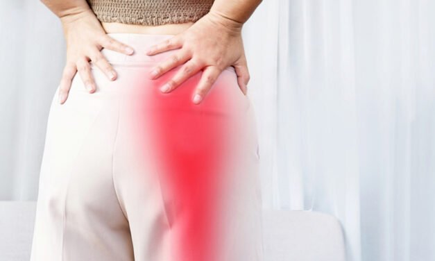 Cupping Therapy for Sciatica: A Gentle, Holistic Approach to Pain Relief