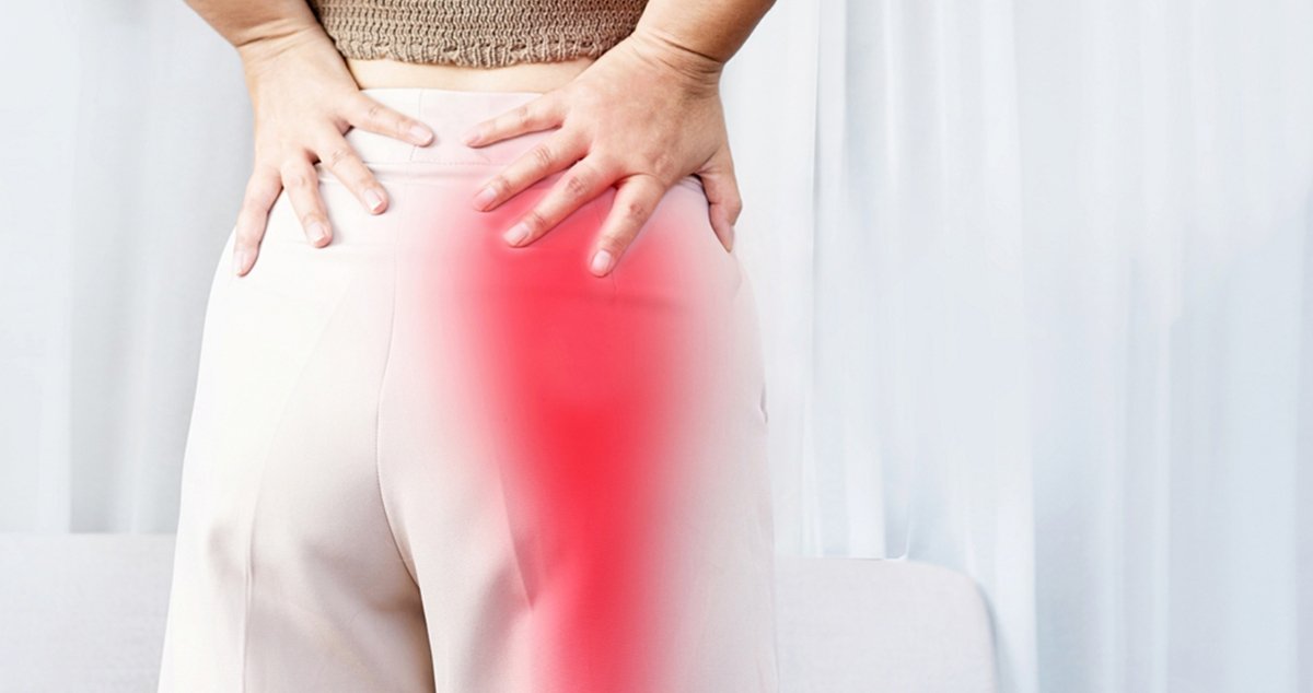 Cupping Therapy for Sciatica: A Gentle, Holistic Approach to Pain Relief