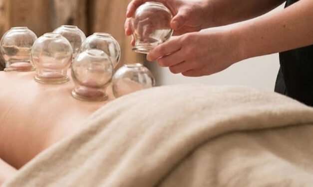 Cupping for Anxiety: How It Stimulates the Parasympathetic Nervous System