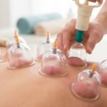 Wet Cupping (Hijama) vs. Dry Cupping: What’s the Difference?