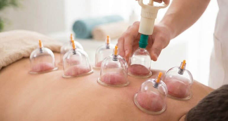 Wet Cupping (Hijama) vs. Dry Cupping: What’s the Difference?